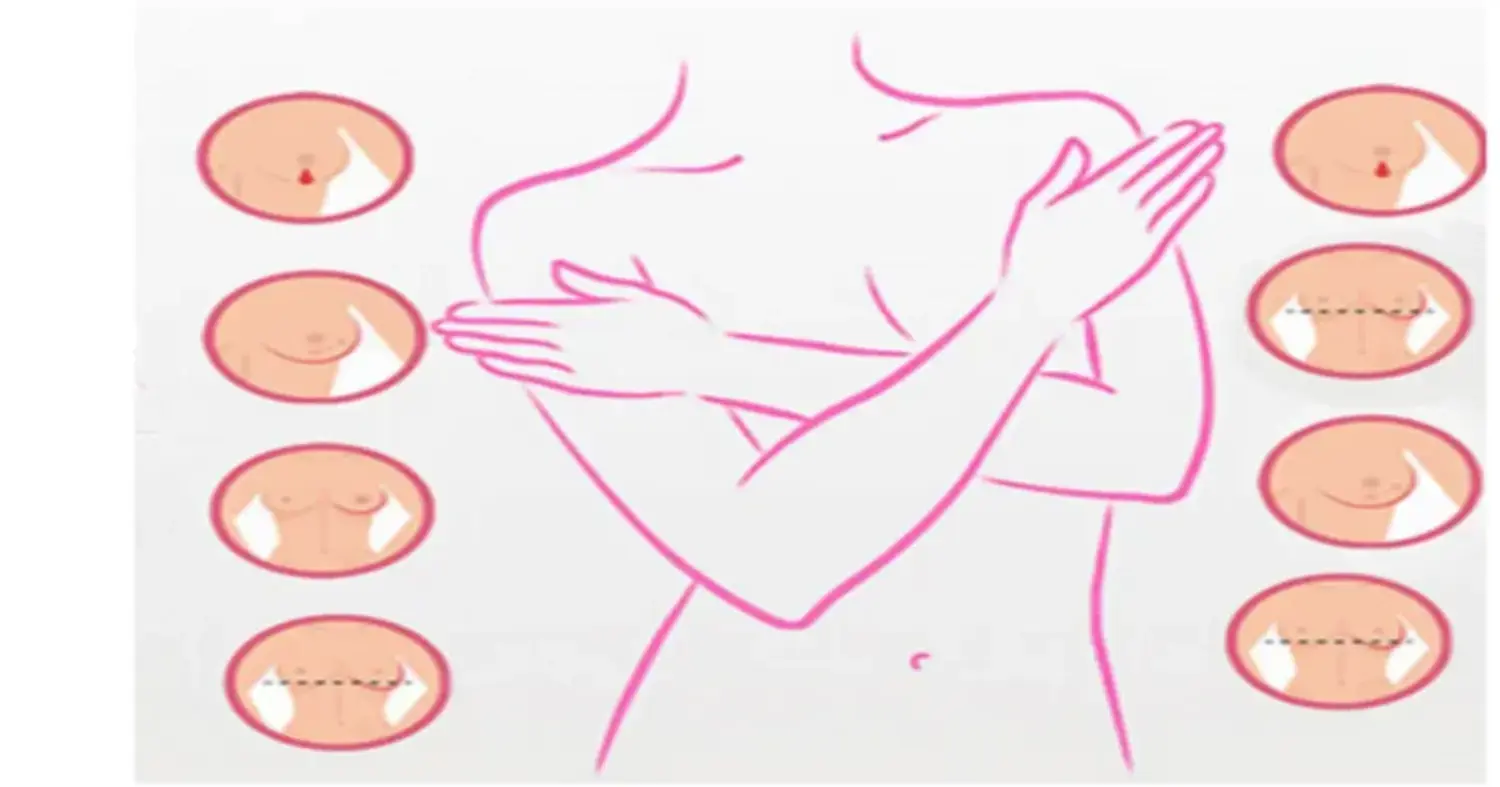 स्तन स्वास्थ्य शिक्षा : स्तन स्वास्थ्य के बारे में वह सब कुछ जो आपको जानना आवश्यक है